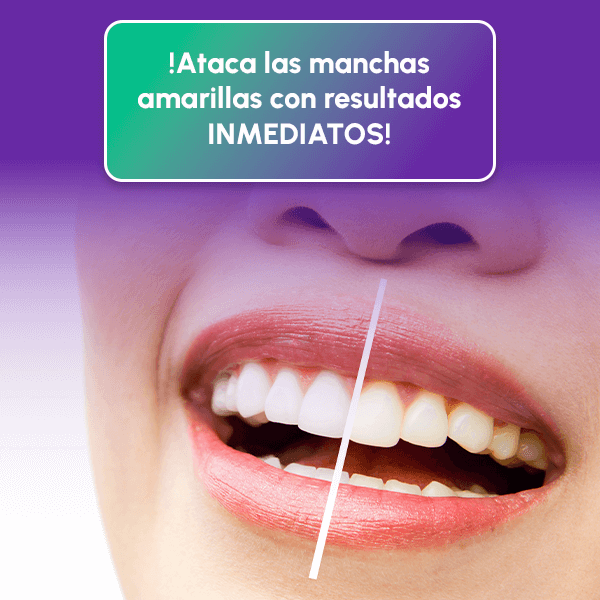 Paga 1 Lleva 2 Lápiz Blanqueador Dental - DAZZLING WHITE + REGALO