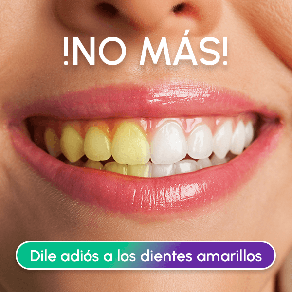 Paga 1 Lleva 2 Lápiz Blanqueador Dental - DAZZLING WHITE + REGALO
