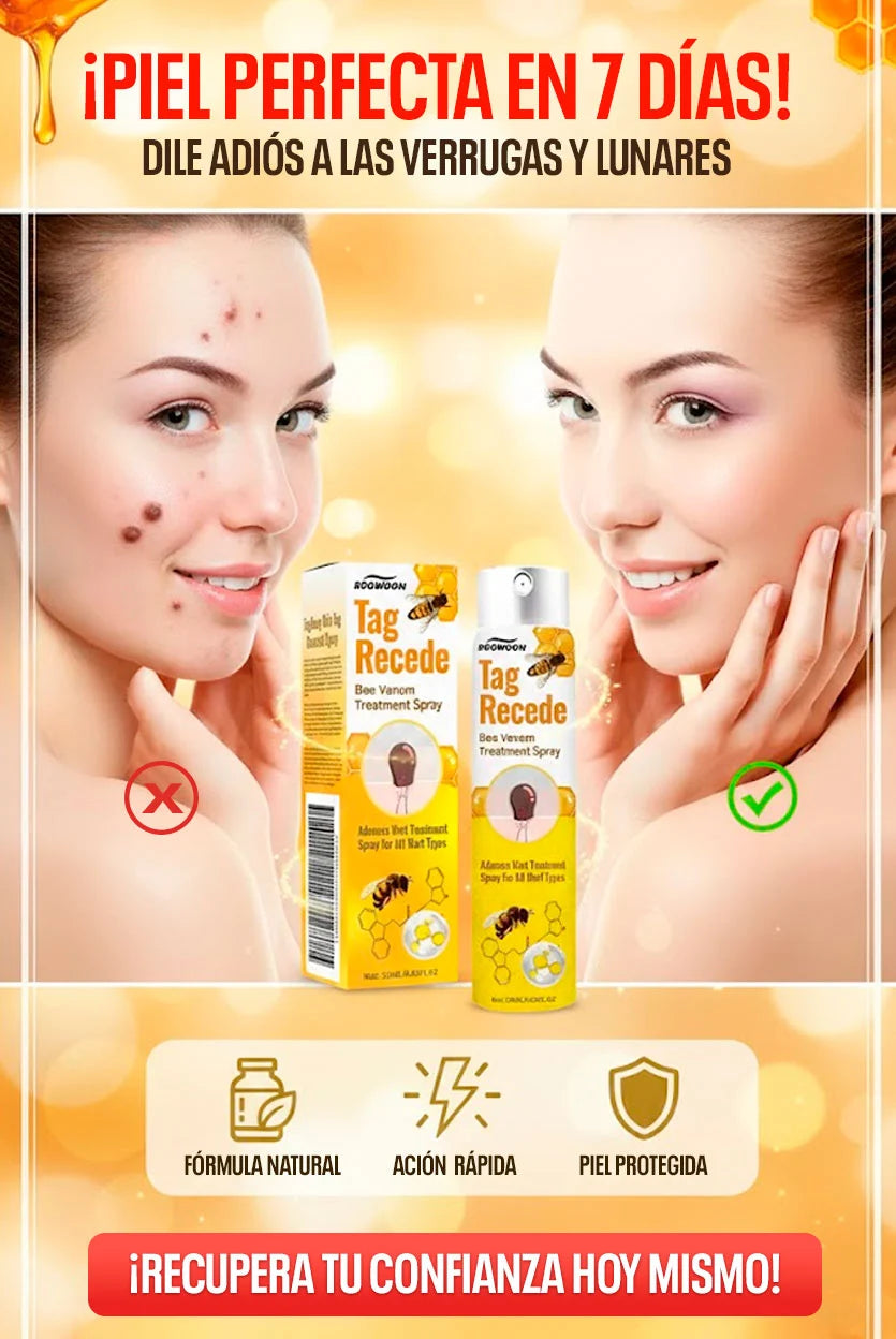 Tag Recede – Spray contra Verrugas y Tags de Piel con Veneno de Abeja